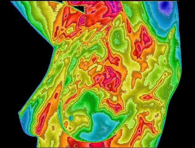 Thermogram No. 1