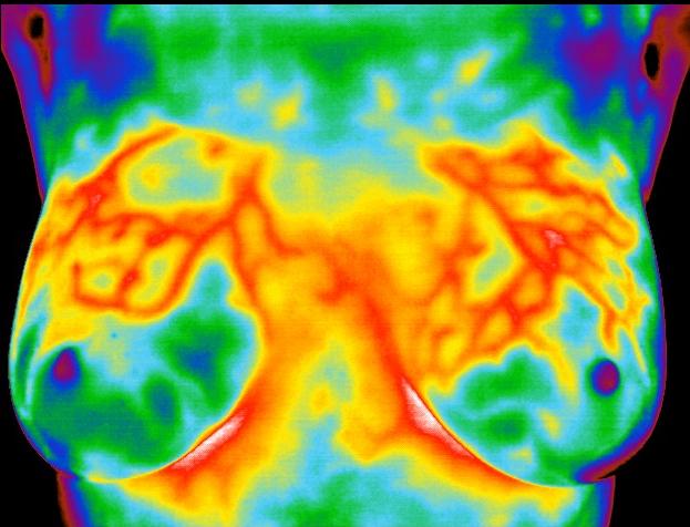 Thermogram No. 2